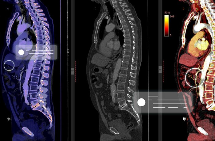 DICOM Image Generation Module to Visualize AI Findings