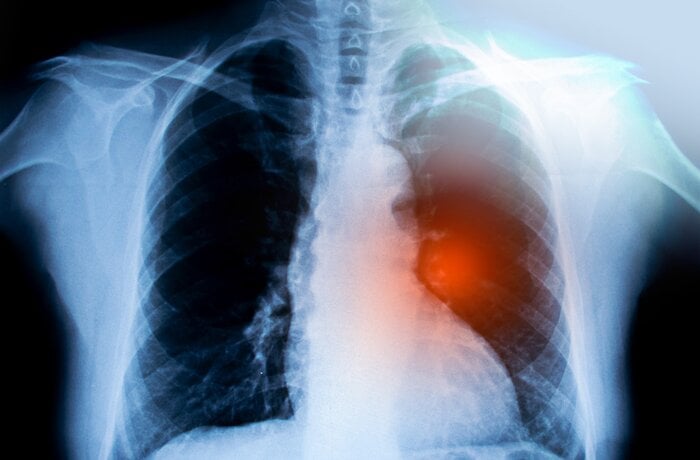 تطوير تطبيق للكشف عن سرطان الرئة لصالح شركة bioAffinity Technologies