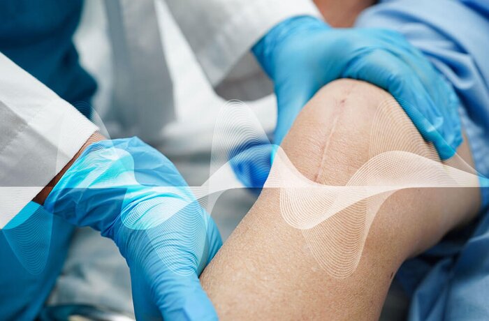 Discovery for Regulatory Submission and Technical Design of Wound Treatment Device Apps