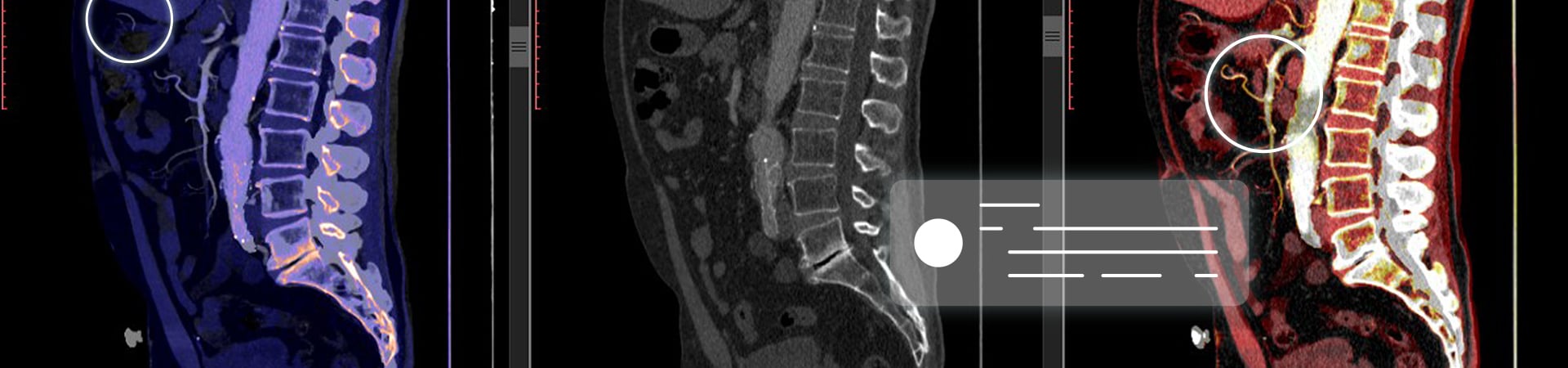 DICOM Image Generation Module to Visualize AI Findings