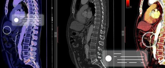 DICOM Image Generation Module to Visualize AI Findings