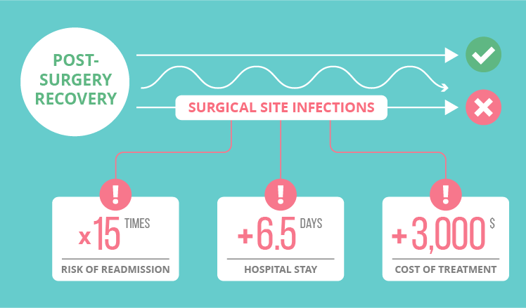Post-surgery recovery