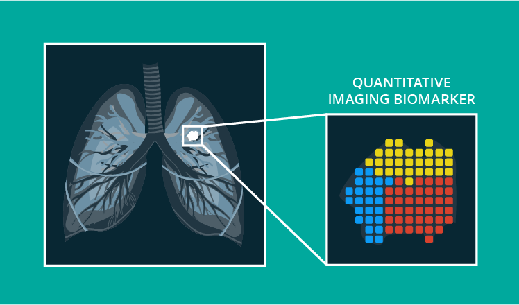 Quantitative imaging biomarkers: From subjective observations to objective characteristics