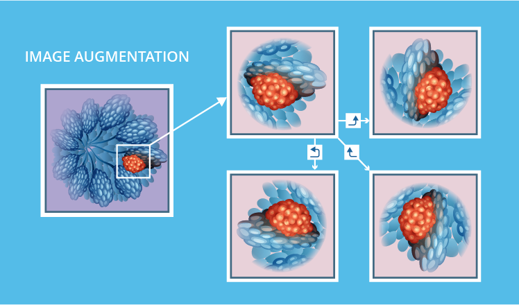 Image augmentation